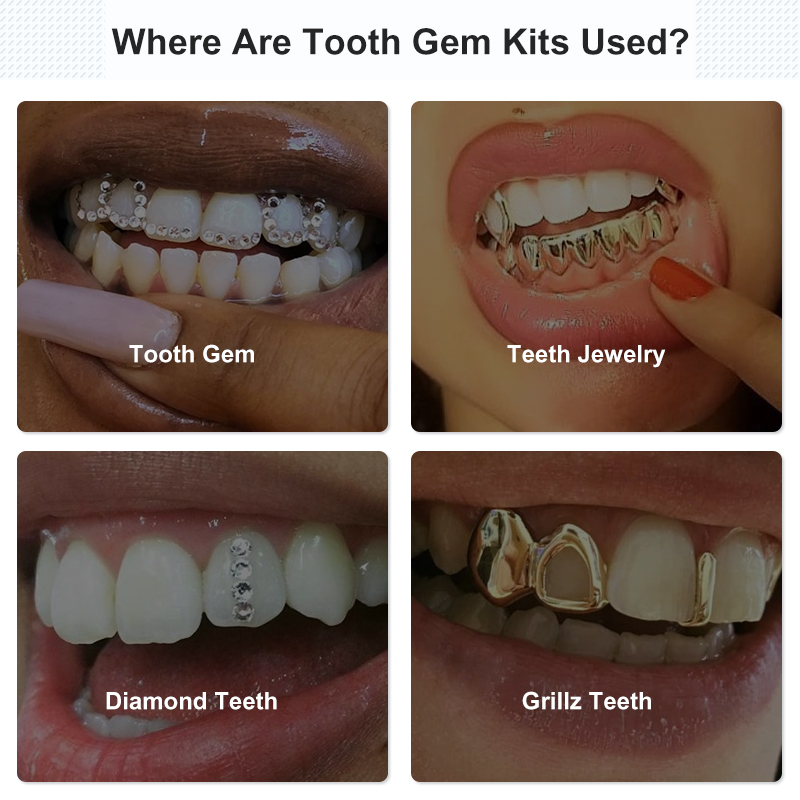 Tooth Gem Set Glue Kit with UV - Resin Art Jewellery review and price